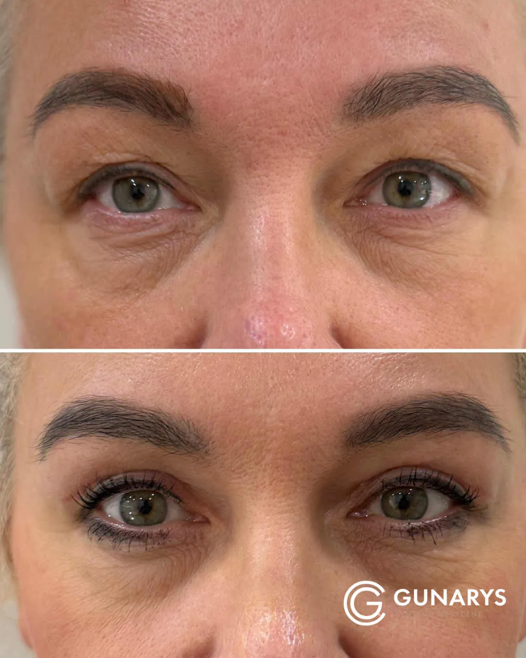 Dlaczego NIE warto bać się pla