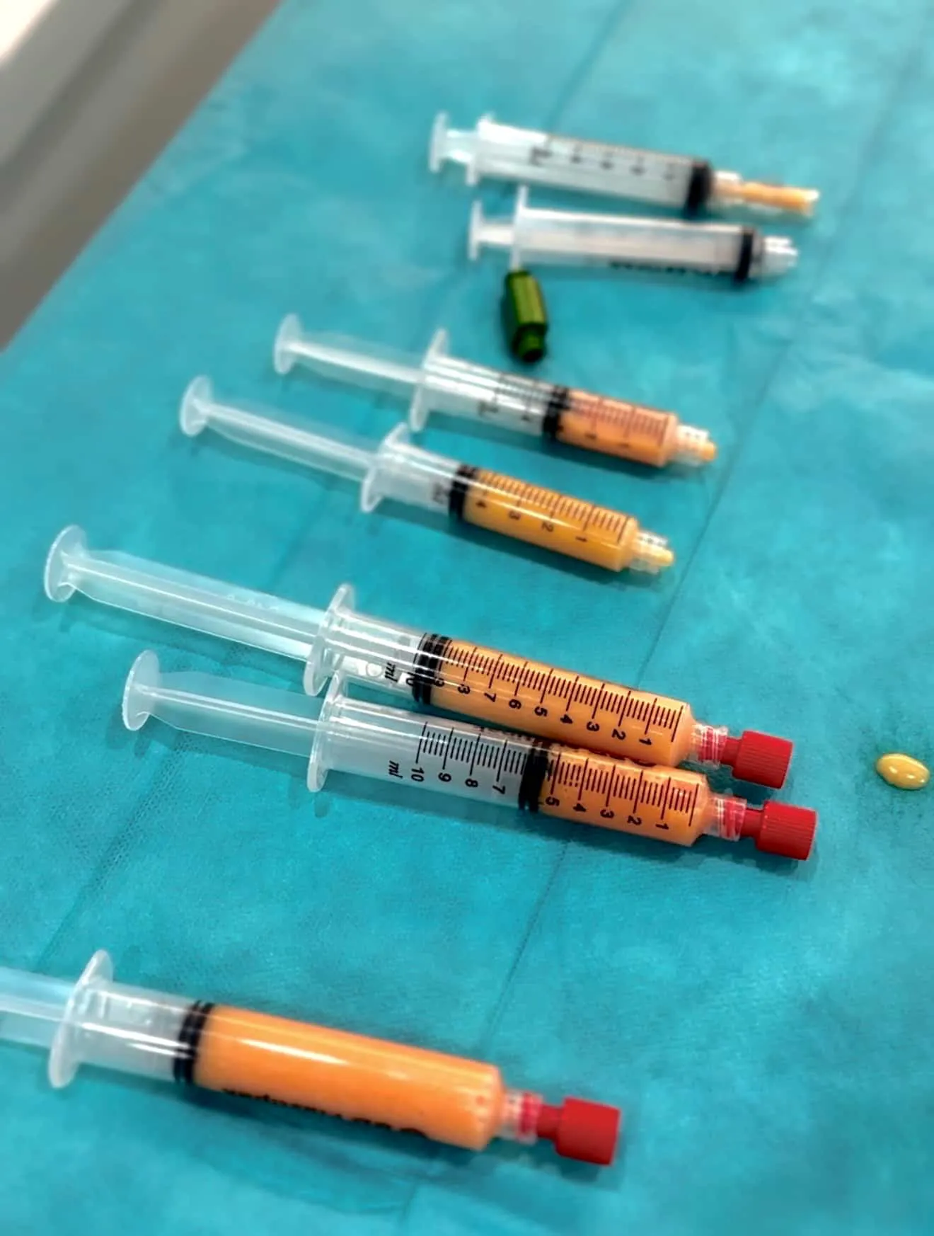 lipotransfer-przeszczep-tluszczu-gdansk